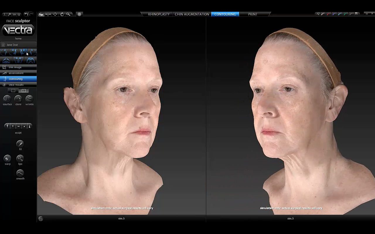 Medicina Estetica Simulaçao 3D